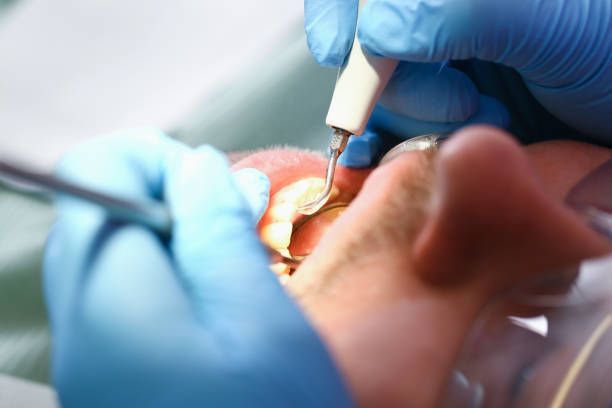 Best Cosmetic Emergency Dentistry in Kechi, KS