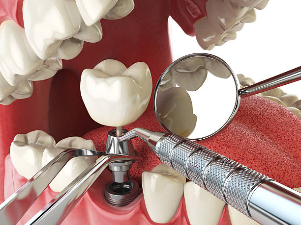 Best Emergency Dental Care for Broken or Chipped Teeth in Kechi, KS