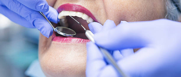 Best Emergency Tooth Extraction in Kechi, KS
